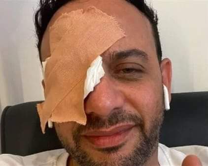 بوكس من خالد سرحان.. تفاصيل إصابة مصطفى قمر خلال تصوير فيلمه الجديد 