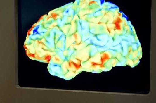ما هو ضباب الدماغ؟
