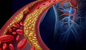 دراسة: أمل جديد يحمي من الإصابة بأمراض القلب ويُخفض الكوليسترول