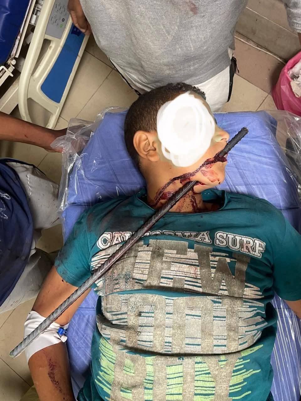 تفاصيل عملية إستغرقت 5 ساعات 
