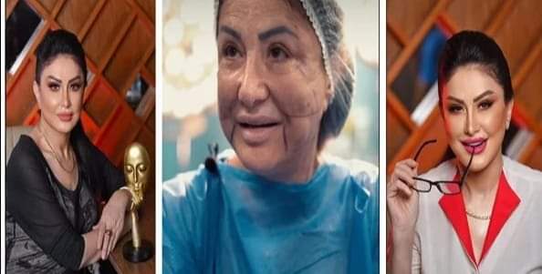 الفنانة وفاء سالم تكشف تفاصيل مأساتها من عمليات التجميل الخاطئة